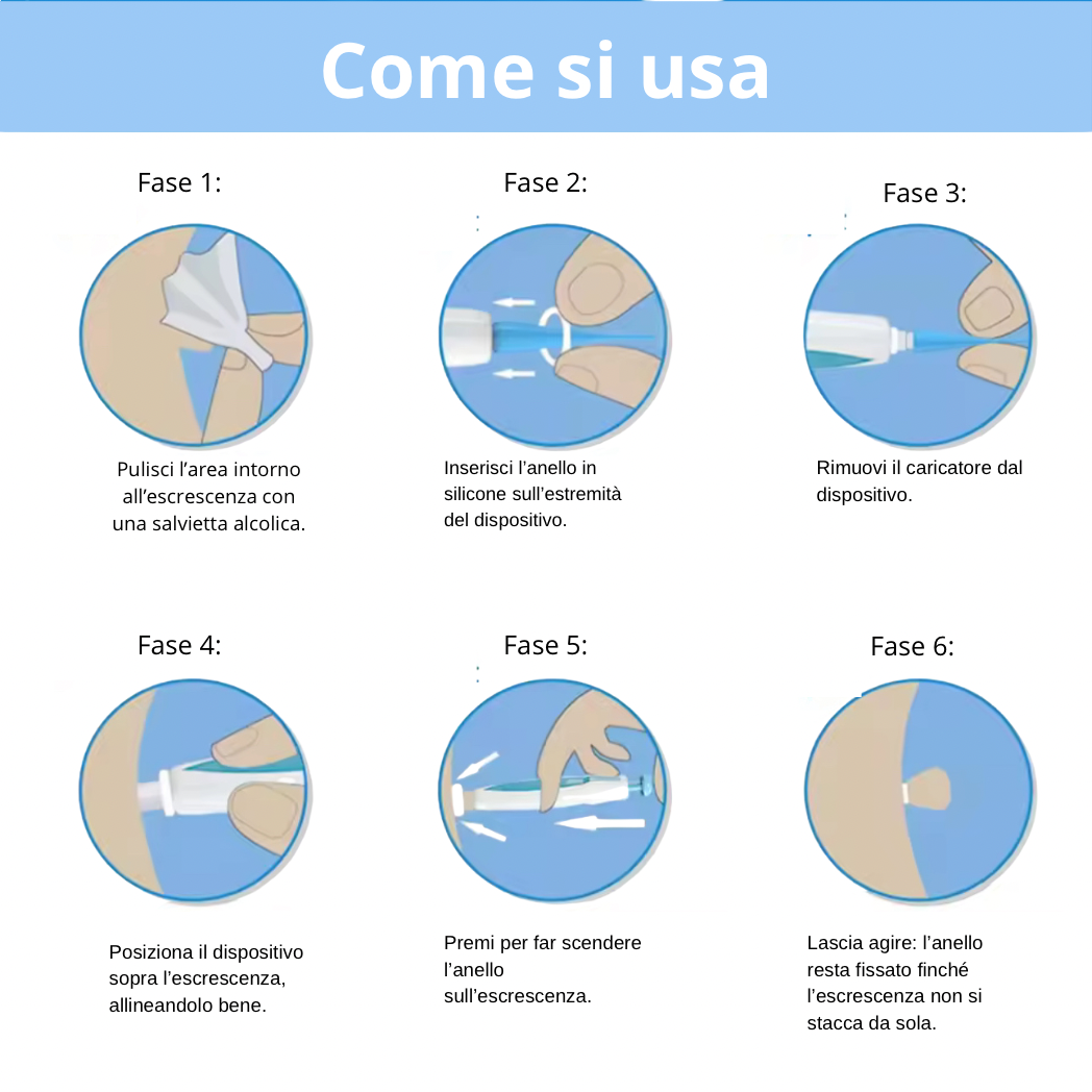 Dermaclare™ – Elimina le escrescenze da casa tua - kevana