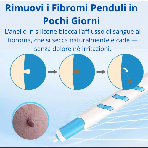 Dermaclare™ –Addio fibromi penduli - kevana