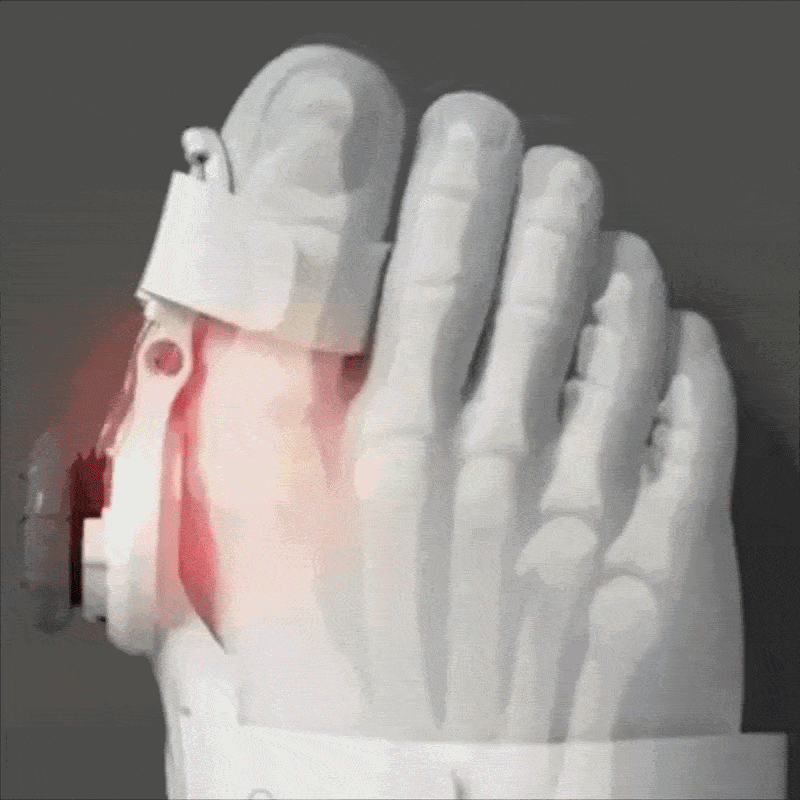 FisioLine Pro™ Sollievo alluce valgo senza chirurgia - kevana 