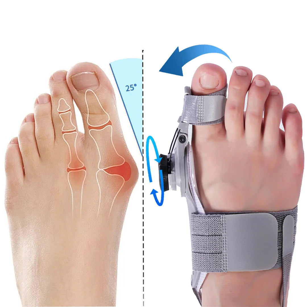FisioLine Pro™ Sollievo alluce valgo senza chirurgia - kevana 