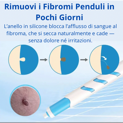 Dermaclare™ –Addio fibromi penduli - kevana 