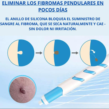 Dermaclear™ – Adiós, lunares y verrugas cutáneas