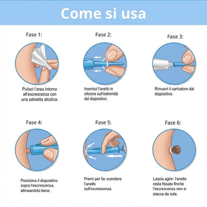 Dermacleare™ – Elimina i fibromi in pochi giorni. - kevana 